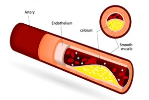 artery depiction
